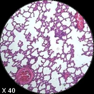 poumonratx40